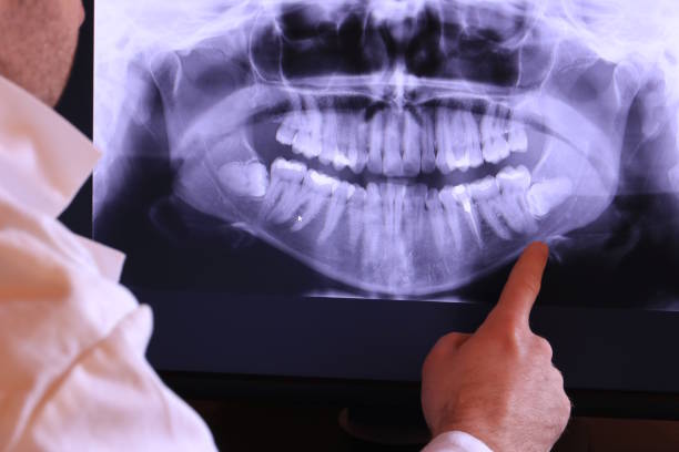 Best Emergency Denture Repair in Decatur, IL