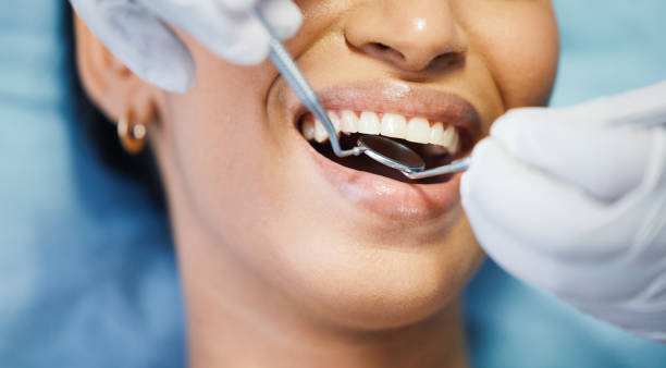 Best Emergency Dental Care for Broken or Chipped Teeth in Decatur, IL