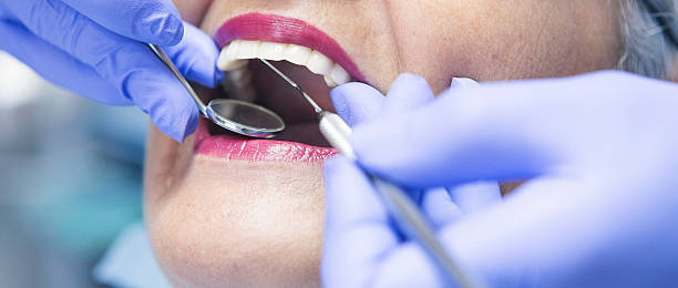 Best Emergency Dental Care for Broken or Chipped Teeth in Decatur, IL